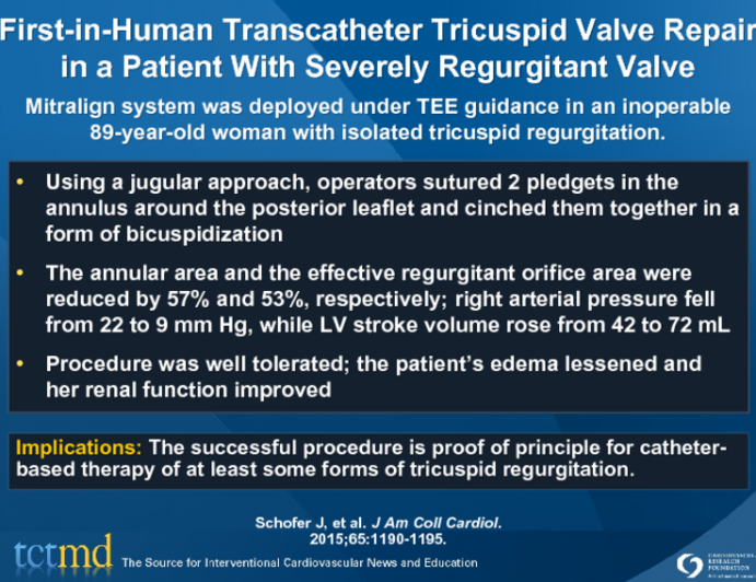 First-in-Human Transcatheter Tricuspid Valve Repair in a Patient With Severely Regurgitant Valve