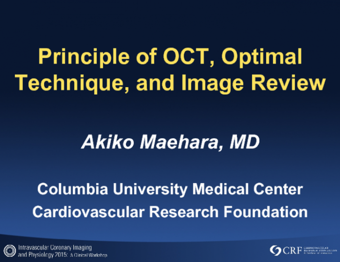 Principle of OCT, Optimal Technique, and Image Review