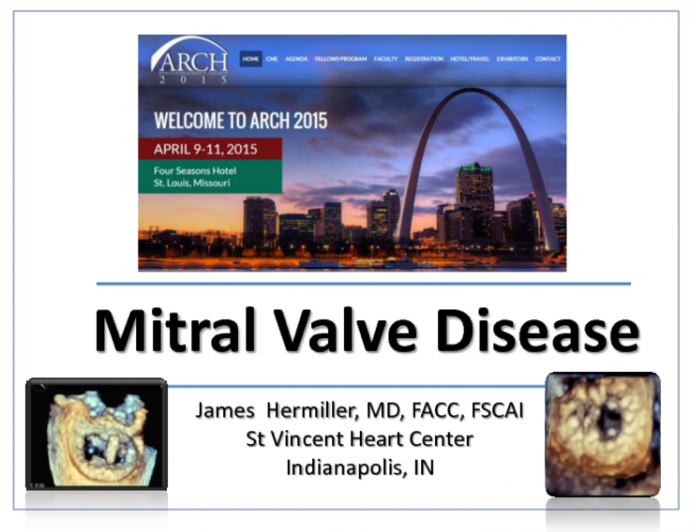 Mitral Valve Disease