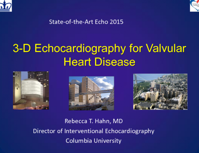 3-D Echocardiography for Valvular Heart Disease
