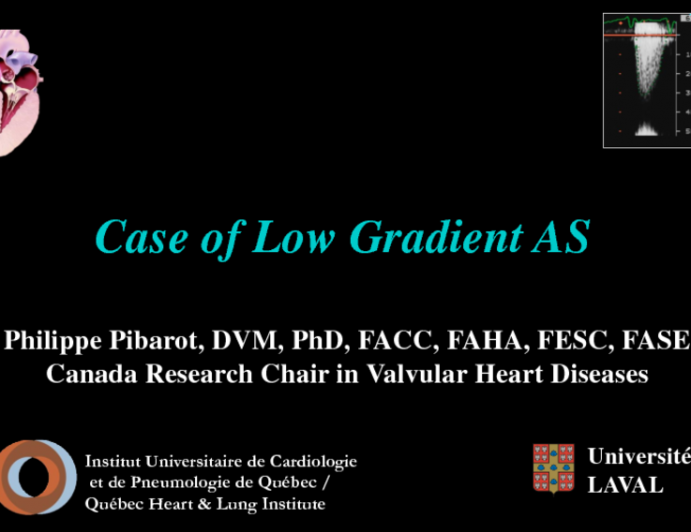 Case of Low Gradient AS