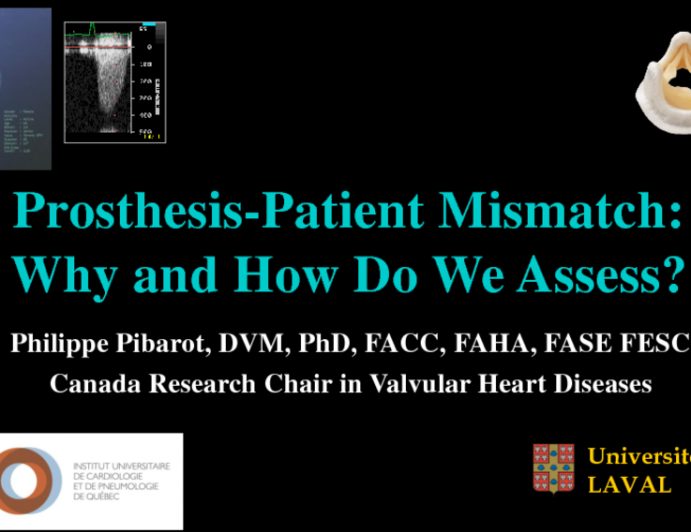 Prosthesis-Patient Mismatch: Why and How Do We Assess?