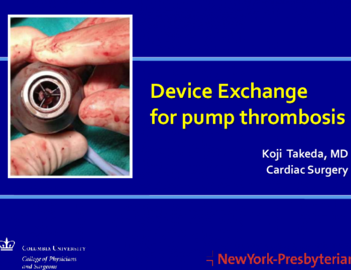 Device Exchange for pump thrombosis