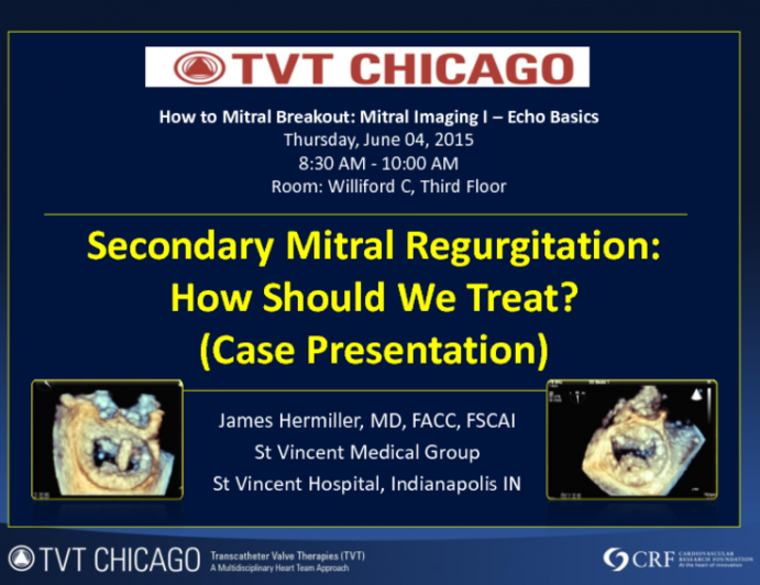 Secondary Mitral Regurgitation: How Should We Treat? (Case Presentation)