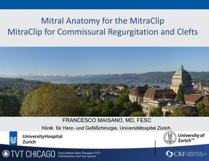 MitraClip for Commissural Regurgitation and Clefts