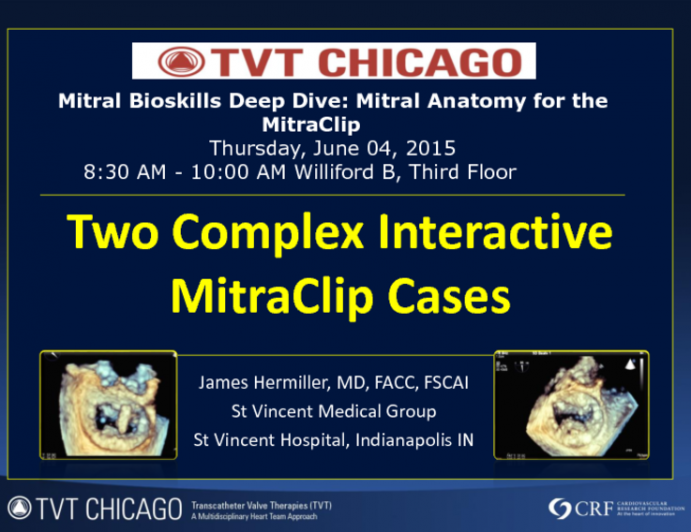 Two Interactive Complex MitraClip Cases