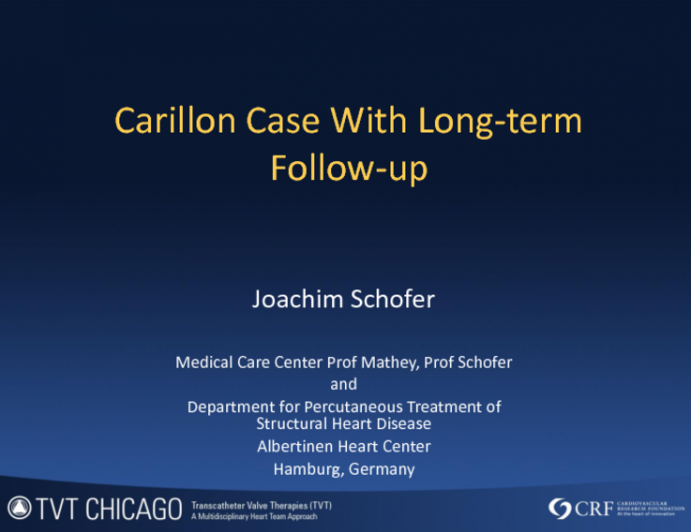 Carrillon Case With Long-term Follow-up