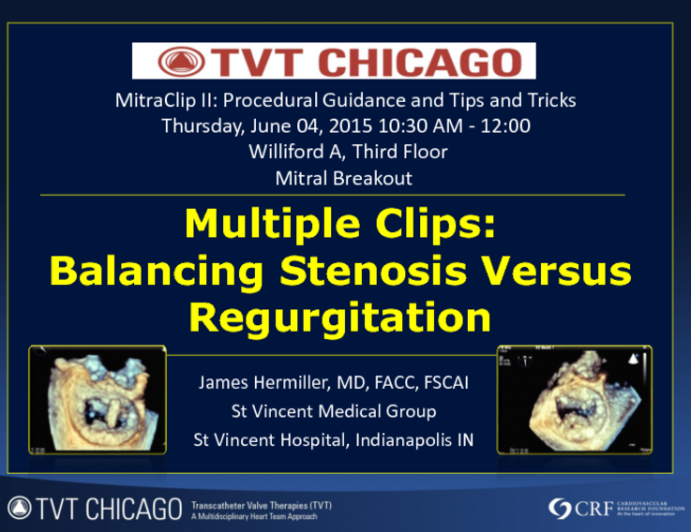 Multiple Clips: Balancing Stenosis Versus Regurgitation