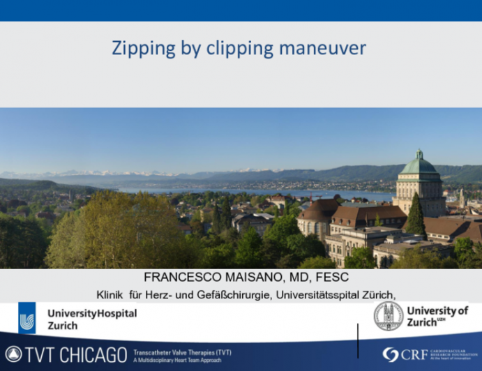 Zip and Clip Maneuver