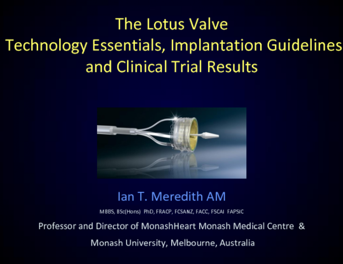 Technology Essentials, Implantation Guidelines, and Clinical Trial Results