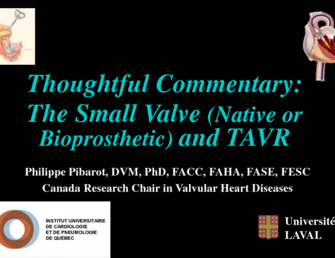 Thoughtful Commentary: The Small Valve (Native or Bioprosthetic) and TAVR