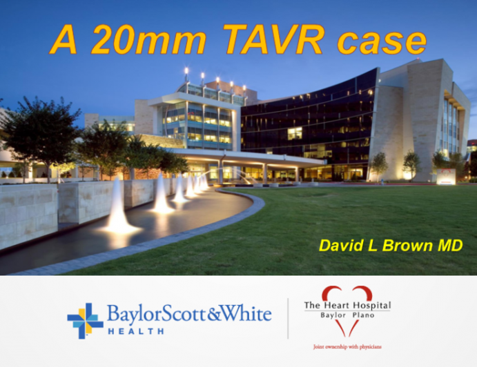 Case Presentation: The Small Valve (Native or Bioprosthetic) and TAVR