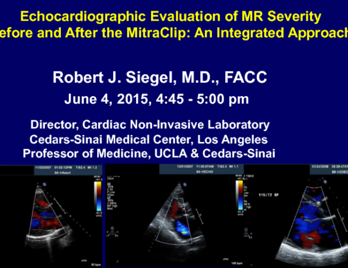 Echocardiographic Evaluation Of Mr Severity Before And After The Mitraclip An Integrated