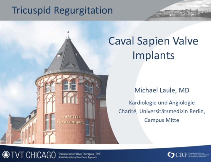 Caval Sapien Valve Implants for Tricuspid Regurgitation