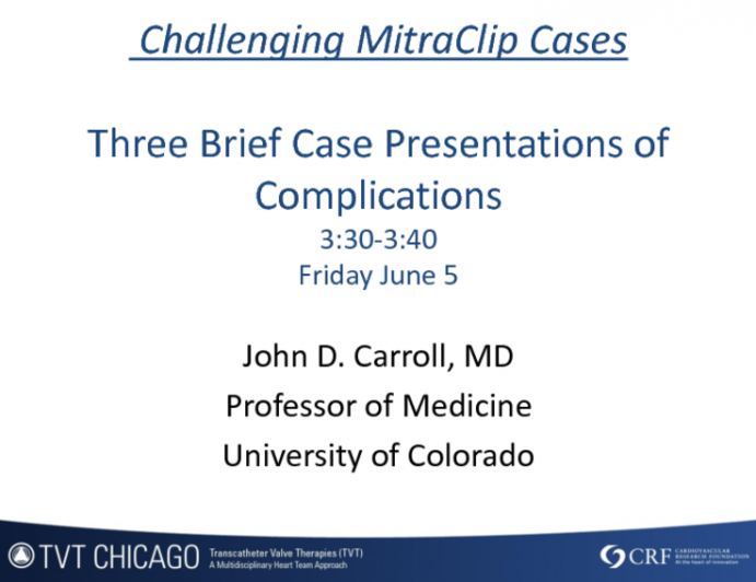 Case Presentation: MitraClip Complication