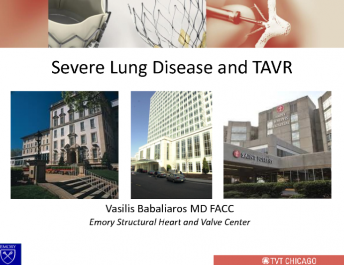 Case Presentation: Severe Lung Disease and TAVR