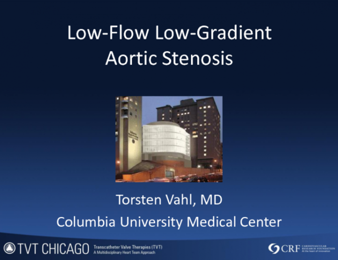 Case Presentation: Low Flow  Low Gradient AS and TAVR