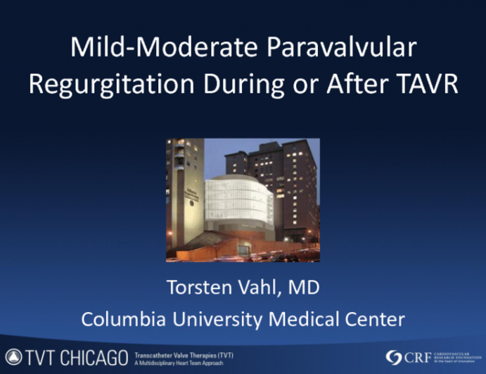 Case Presentation: Mild-Moderate Paravalvular Regurgitation During/After TAVR