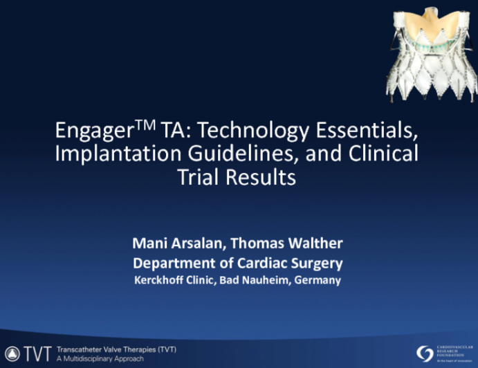 Technology Essentials, Implantation Guidelines, and Clinical Trial Results