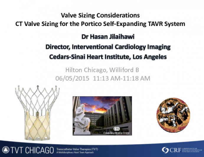 CT Sizing for Other New TAVR Systems: Roundtable Discussion - Portico Valve