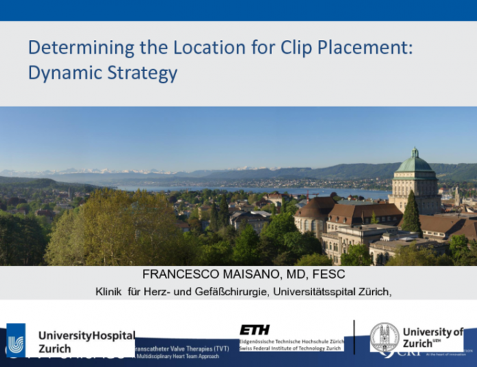 Determining the Location for Clip Placement: Dynamic Strategy