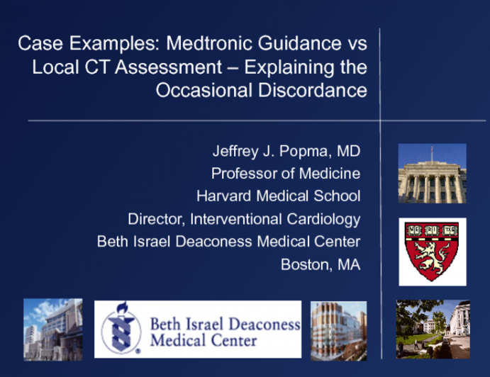 Case Examples: Medtronic Guidance vs Local CT Assessment  Explaining the Occasional Discordance