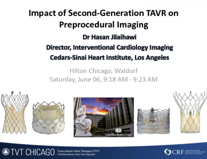 Impact of Second-Generation TAVR on Preprocedural Imaging