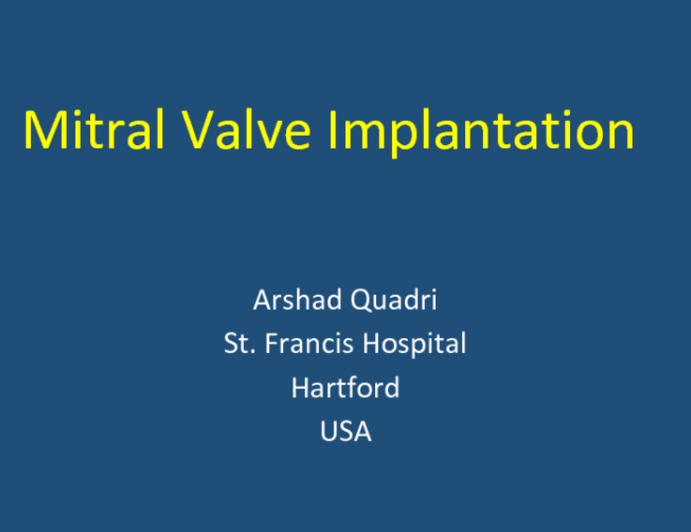 Mitral Valve Implantation