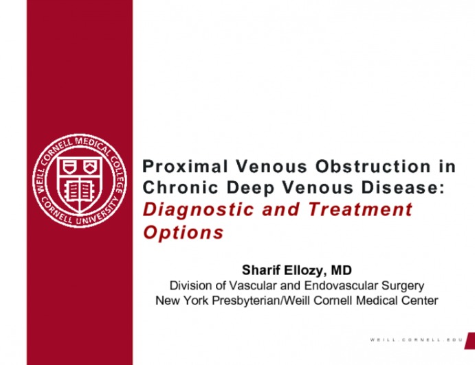 Proximal Venous Obstruction in Chronic Deep Venous Disease: Diagnostic and treatment options?