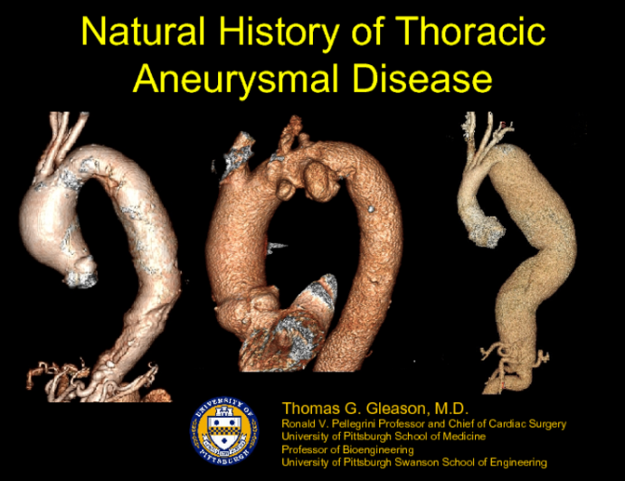 Natural History of Thoracic Aneurysmal Disease