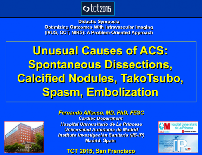 Unusual Causes of Acute Coronary Syndrome: Spontaneous Dissections, Calcified Nodules, Takotsubo, Embolization, and More