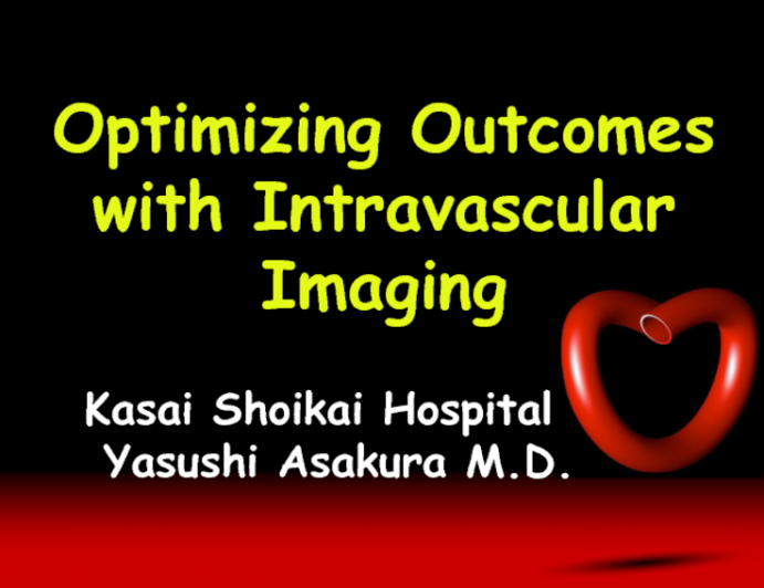 Treating CTO Lesions With Imaging Guidance | tctmd.com