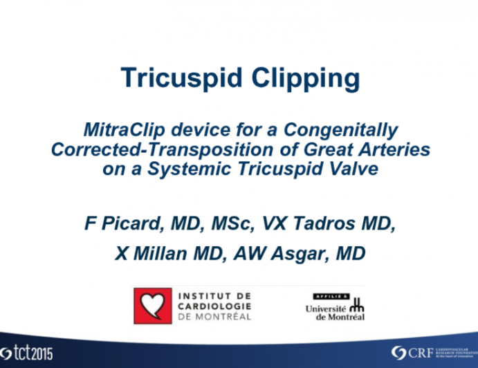 CASE 2: Tricuspid Clipping: MitraClip Device for a Congentially Corrected Transposition of Great Arteries on a Systemic Tricuspid Valve