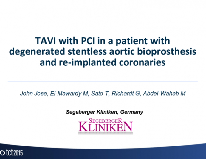 Case 2: TAVI With PCI in a Patient With Degenerated Stentless Aortic Bioprosthesis and Reimplanted Coronaries