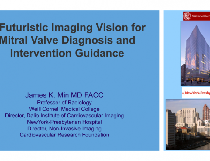 A Futuristic Imaging Vision for Mitral Valve Diagnosis and Intervention Guidance