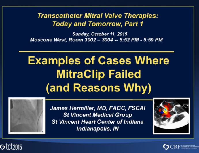 Examples of Cases Where MitraClip Failed (and Reasons Why)