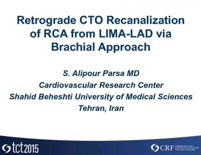 CTO of a Right Coronary Artery via the LIMA