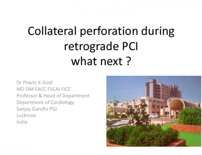 Leak in Collateral Vessel During Retrograde PCI