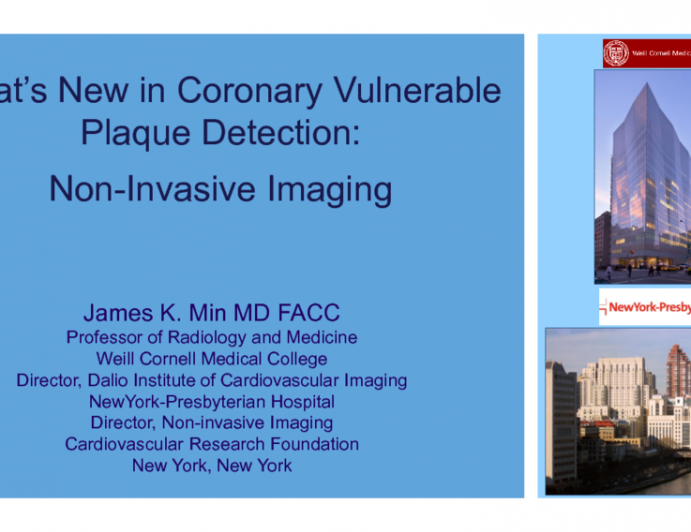 Whats New in Coronary Vulnerable Plaque Detection: Noninvasive Imaging