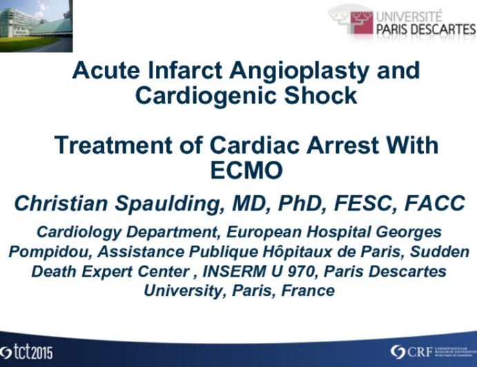 Treatment of Cardiac Arrest With ECMO
