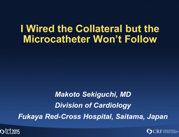 Problem (and Solution) 1: I Wired the Collateral but the Microcatheter Wont Follow