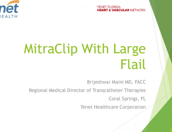 MitraClip Treatment of Very Tall/Wide Flails