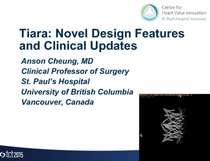 Tiara: Novel Design Features and Clinical Updates