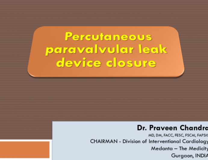 India Presents: Redo of Device Closure With Mitral Paravalvular Leak