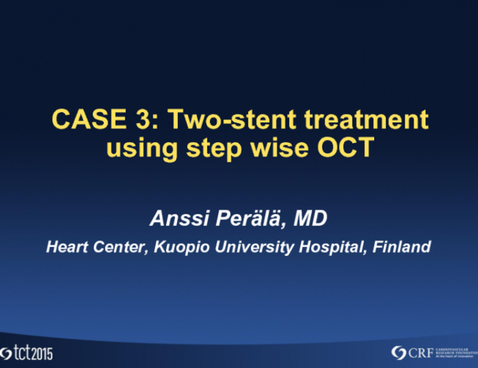 Case 3: Two-Stent Treatment Using Stepwise OCT