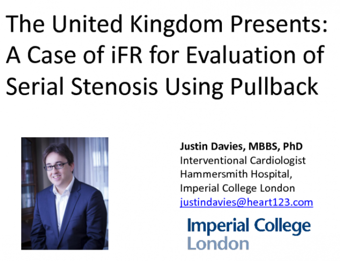 The United Kingdom Presents: A Case of iFR for Evaluation of Serial Stenosis Using Pullback