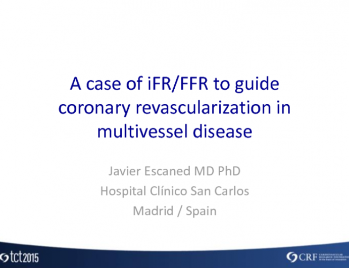 Spain Presents: A Case of iFR-FFR to Guide Coronary Revascularization in Multivessel Disease