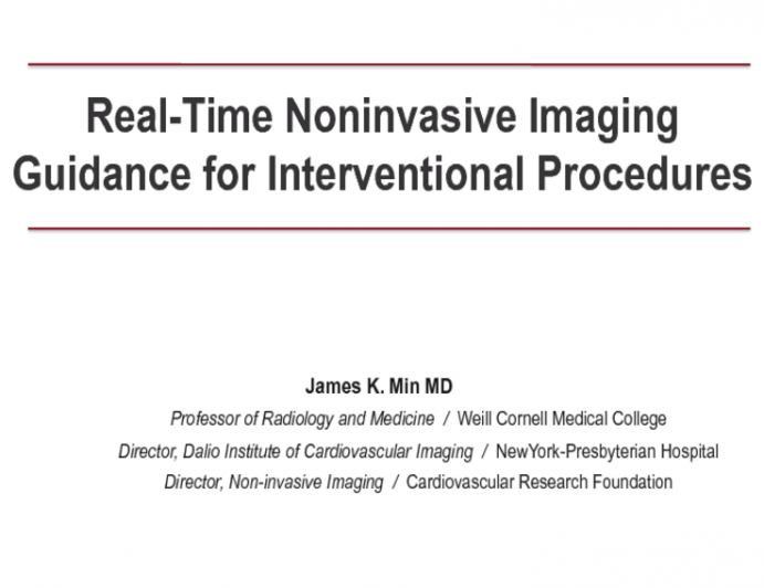 Real-Time Noninvasive Imaging Guidance for Interventional Procedures