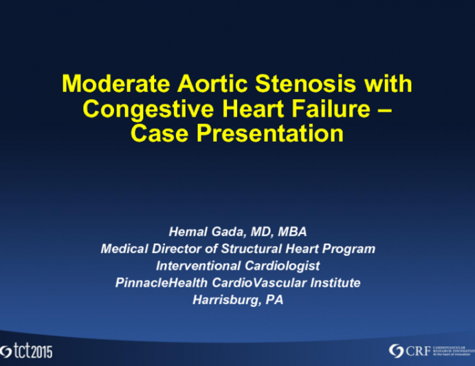 Moderate Aortic Stenosis With CHF: Case Presentation