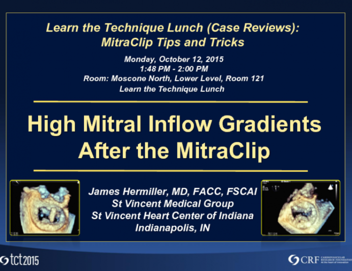 High Mitral Inflow Gradients After the First Clip